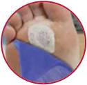 Infection Management and Prevention